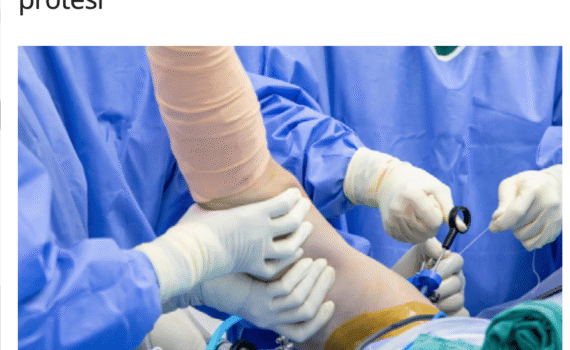 Chirurgia della spalla Ore 12 Sanità WEB Prof. Francesco Franceschi
